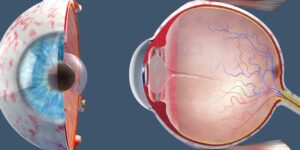 How to Prepare for Cataract Surgery [Complete Guide]
