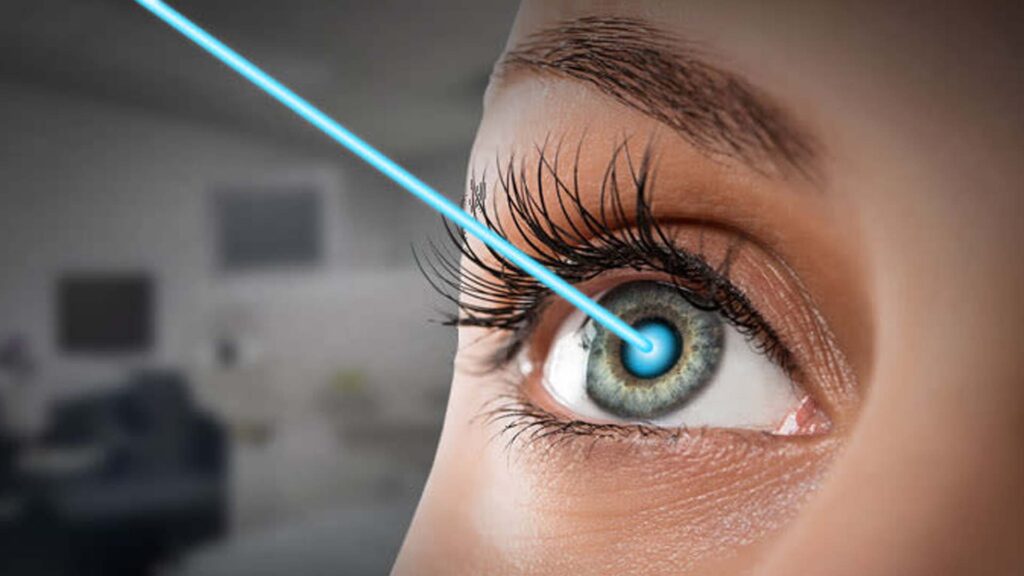 LASIK Eye Surgery