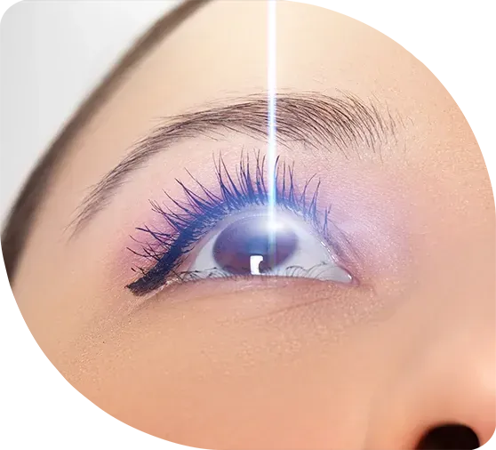 Myths About Lasik Surgery That Are Simply Not True