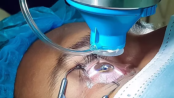 Myths About Lasik Surgery That Are Simply Not True