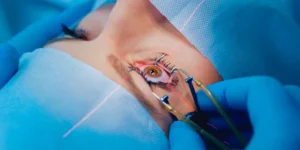 What Makes Laser Eye Surgery Sydney Wait Times Different?