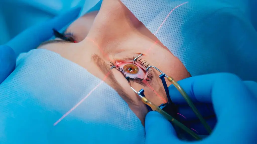 What Makes Laser Eye Surgery Sydney Wait Times Different?